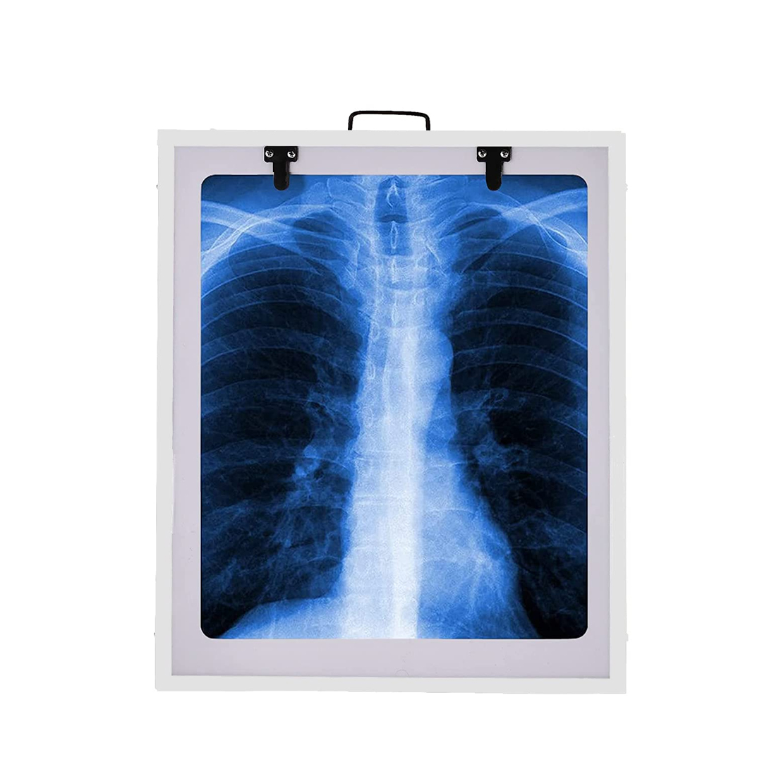 X-Ray Viewer available in online  pharmacy qatar, doha 